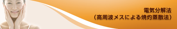 �d�C����@�i�����g���X�ɂ��Ď܏��U�@�j
